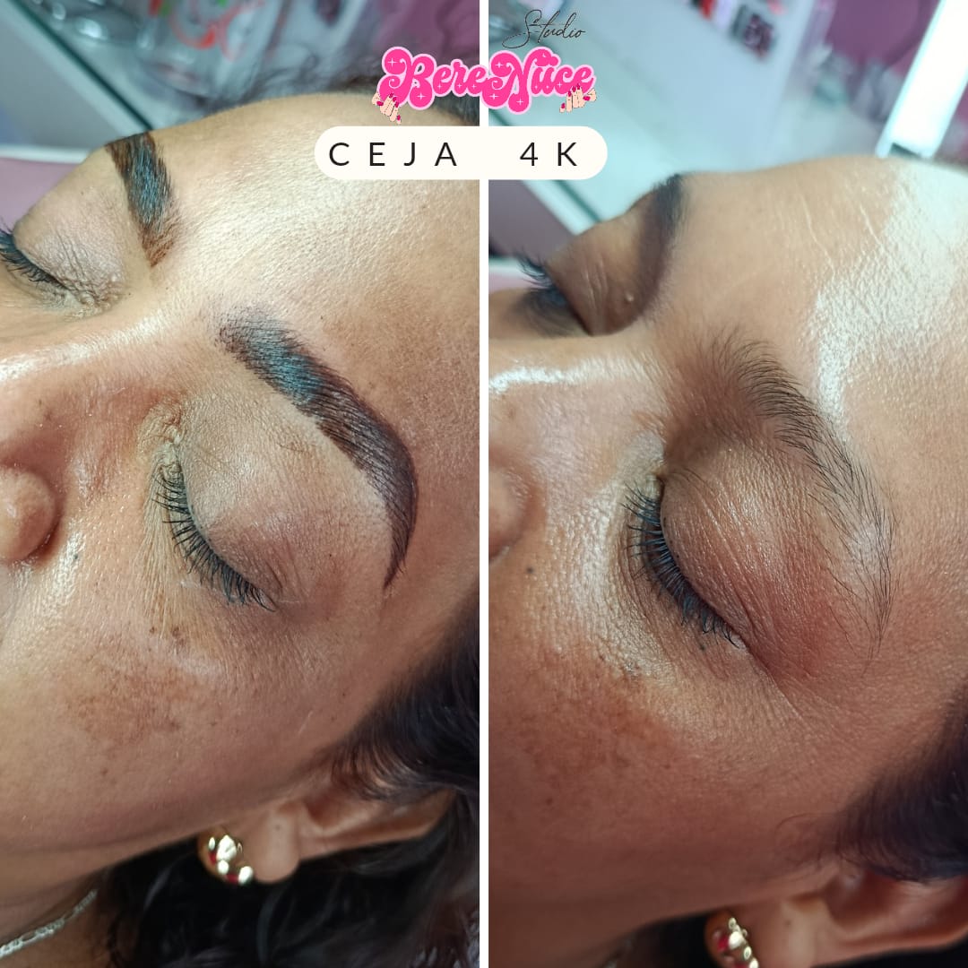 Cejas
